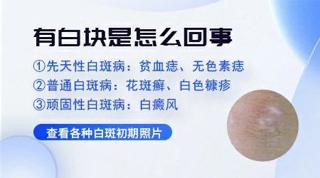 皮肤颜色异常一块变得很白怎么回事