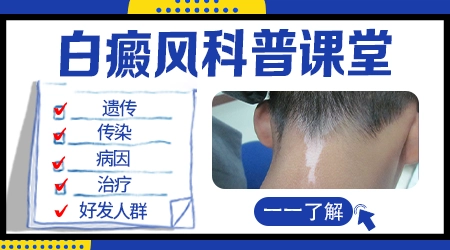 白癜风初期和其他白斑图片对比