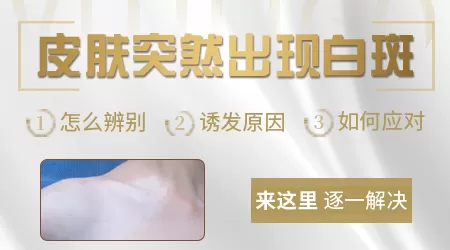 脖子皮肤白一块会是白癜风吗