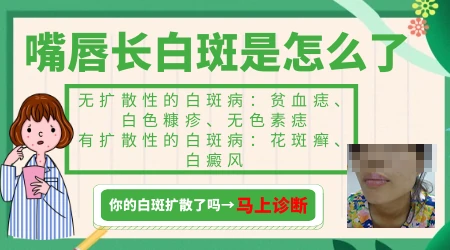 嘴角两边肤色变白怎么回事