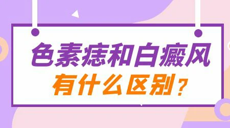 白癜风与无色素痣如何鉴别