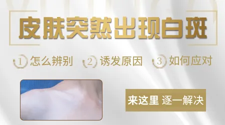 手臂上出现白色斑是什么情况