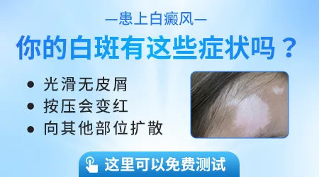 手臂上出现白色斑是什么情况