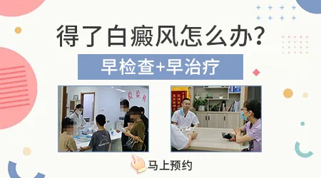 白癜风会先在手指关节长吗