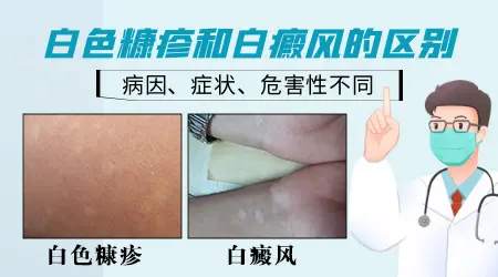 早期白癜风与白色糠疹的对比图