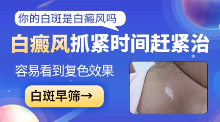 白癜风淡白色斑片多久会变成明显的瓷白色