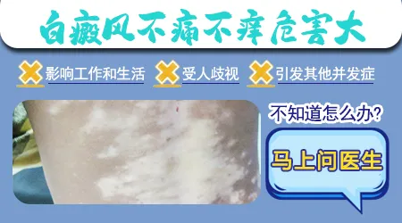 白色糠疹和白癜风哪个严重