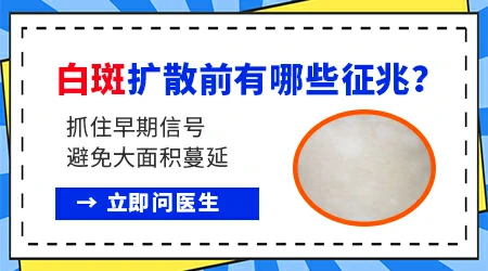 小时候就有的白斑会扩散吗