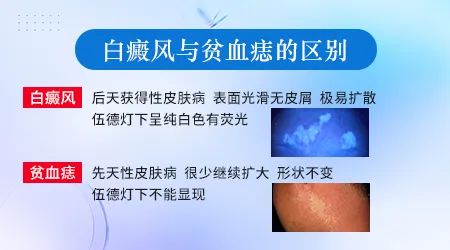 贫血痣和白癜风怎么区分