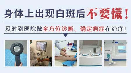 身上白斑光滑无皮屑是什么