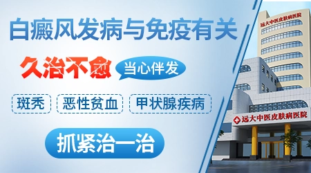 白癜风会引发其他什么并发症