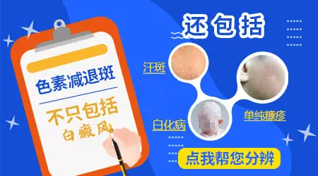 色素减退引起的白斑是不是白癜风