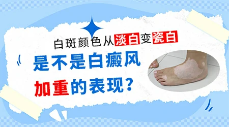 白癜风的白斑颜色一定是瓷白色吗