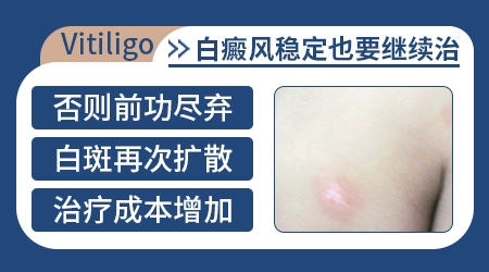 白斑多久没有变化才算进入稳定期