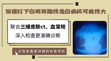 伍德灯弱阳性白斑严重吗