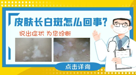 下巴位置长白斑是什么原因