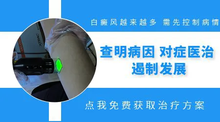 额头上一块白越来越明显怎么回事