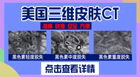 皮肤CT结果显示黑素细胞完全缺失是什么意思