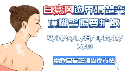 白斑部位边缘变模糊了是要开始扩散吗