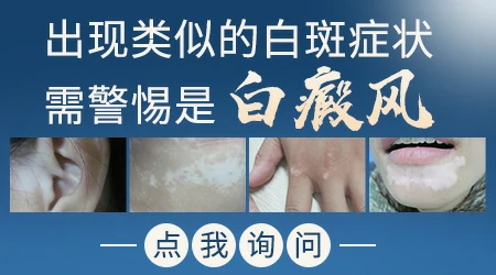 眉毛旁边的皮肤变白了一小块是怎么回事