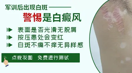 军训后嘴边白了一块是什么情况