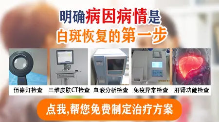 刚发现身上有白片可以先观察吗
