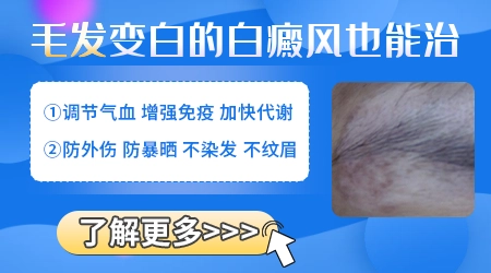 头皮上长了块白斑头发也有点发白正常吗