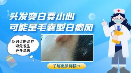 头皮上长了块白斑头发也有点发白正常吗