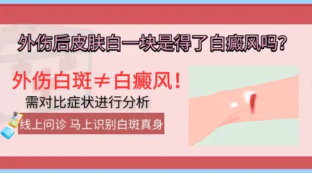 外伤之后长出来的白斑是白癜风吗