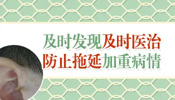 如何区分白癜风与日光性白斑