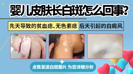 婴儿身上出现白色的块摸着光滑怎么回事