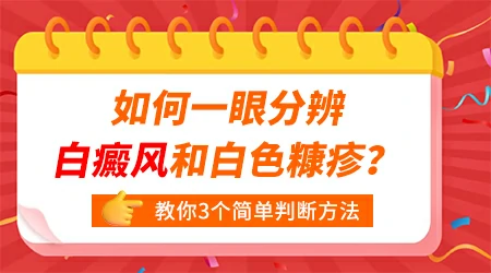白色糠疹和白癜风怎么区分辨别