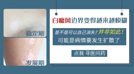 白斑边缘模糊是不是说明还在进展期