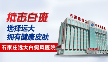 河北邯郸治白癜风的正规医院是哪家
