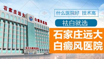 去邯郸治白癜风需要住院吗