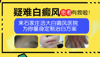 邯郸白癜风医院可靠吗
