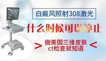 夏天做308激光白癜风恢复效果好吗