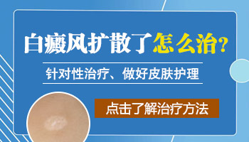 手部嘴唇有白癜风2年今年扩散了怎么治