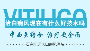 白癜风治疗 邯郸白癜风医院技术