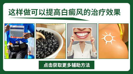 阴茎长了白癜风可以做光疗吗