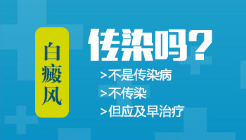 阴茎长了白癜风可以做光疗吗