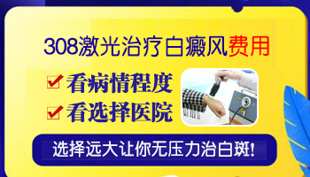 河北省308激光的定价 激光照白癜风收费标准