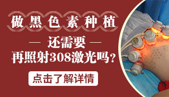 白癜风黑色素种植后需要再照射308激光吗