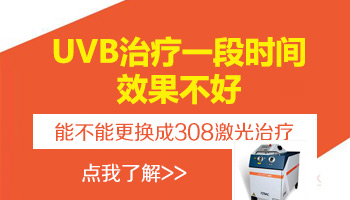 白癜风用311照灯停了一个月了可以改为308吗