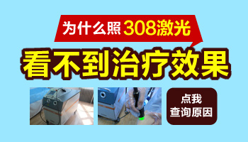 白癜风一直照308激光效果不理想