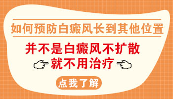 入冬以后白癜风停止扩散了还用治疗吗