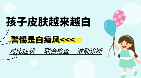 爸爸有白癜风孩子患上白癜风的概率有多大