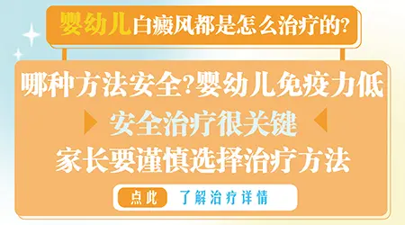 5个多月的孩子白癜风怎么治