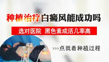 手指白斑做黑色素种植成活率大吗