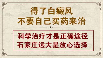 白癜风治疗期间忌口吗